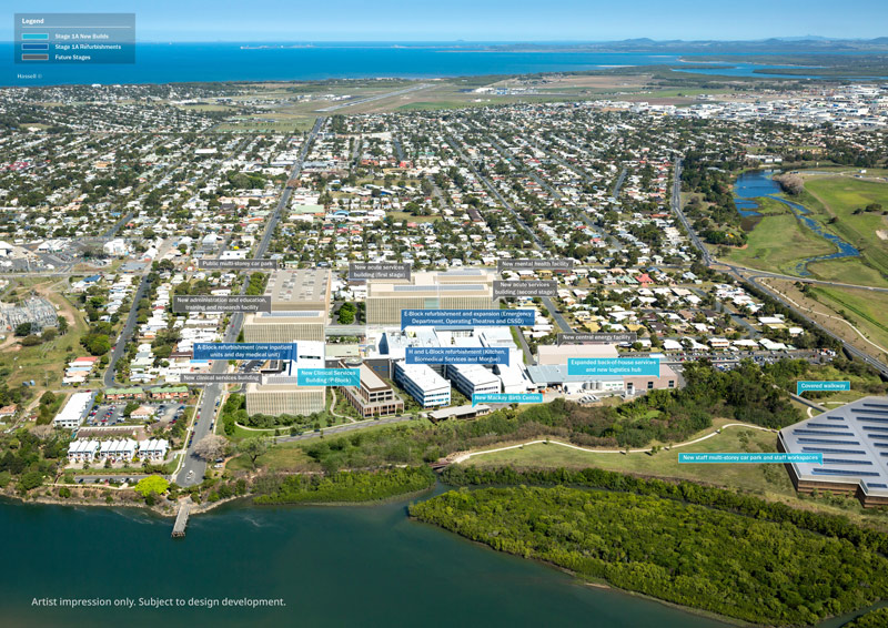 Aerial artist’s impression of the Mackay Hospital campus master plan, showing proposed new buildings, refurbishments and future stages, including expanded clinical services, mental health and birth facilities, car parks, staff workspaces and supporting infrastructure.